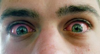 ¿Quieres saber por qué la marihuana te pone los ojos rojos?
